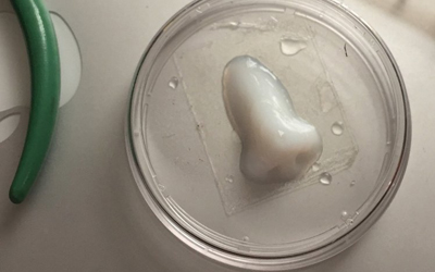 A hydrogel nose created by an Allevi 3D bio printer.